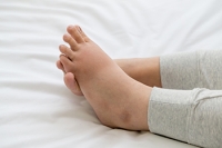 Swollen Feet Can Be Related to Back Pain
